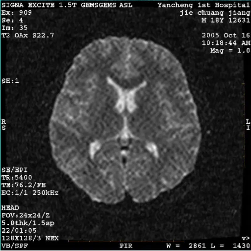 आर्टिफॅक्ट WI/Fiesta इमेज व्हाईट पिक्सेल